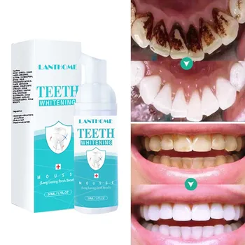 Trvalé Zuby Čistenie Zubov Pena Odstraňuje Škvrny Od Zubného Kameňa, Bielenie Zubov, Ústnej Hygieny Mousse Zubná Pasta Čerstvé Zlý Dych  5
